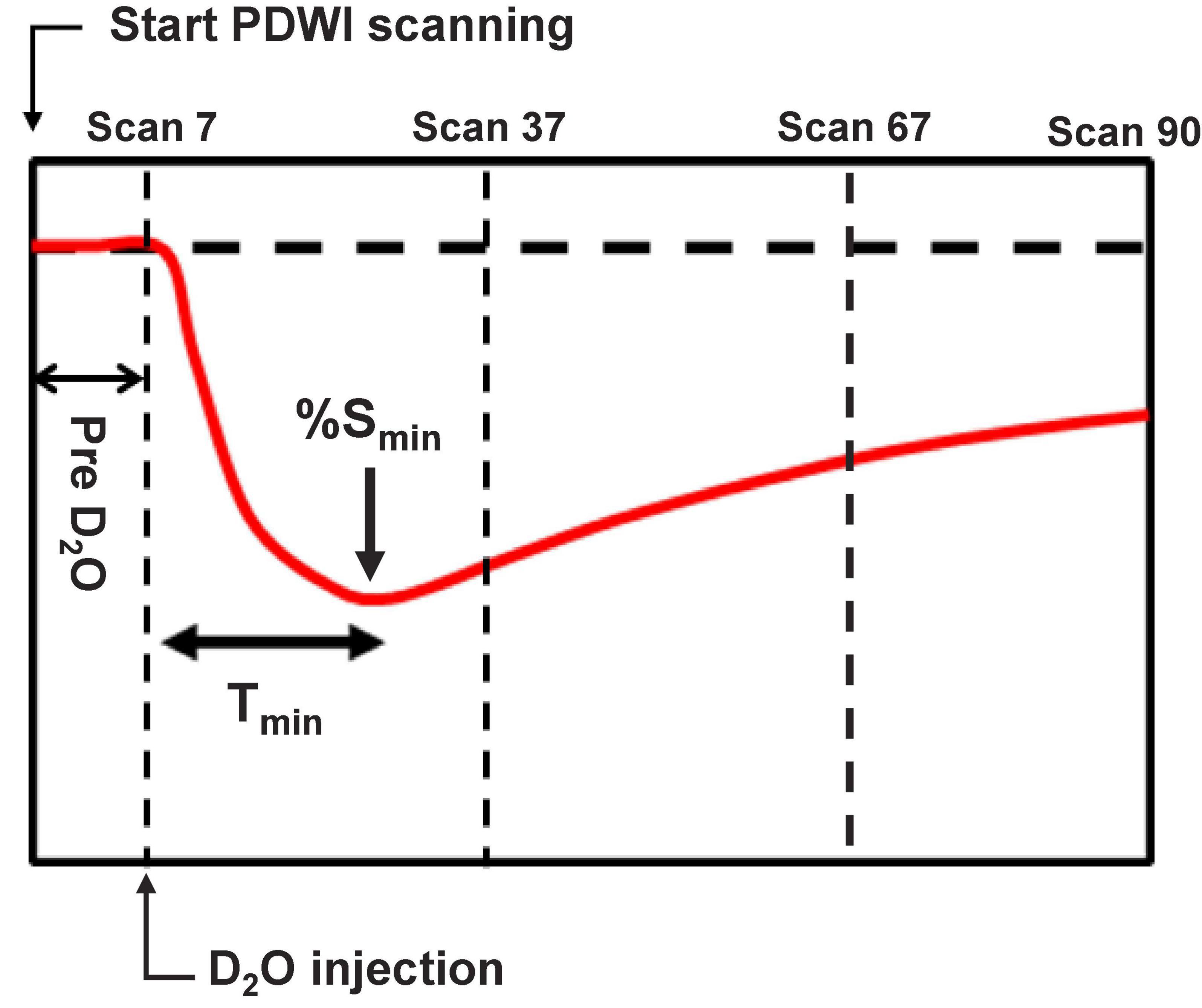 Distribution of intraperitoneally administered deuterium-labeled water in aquaporin-4-knockout mouse brain after middle cerebral artery occlusion